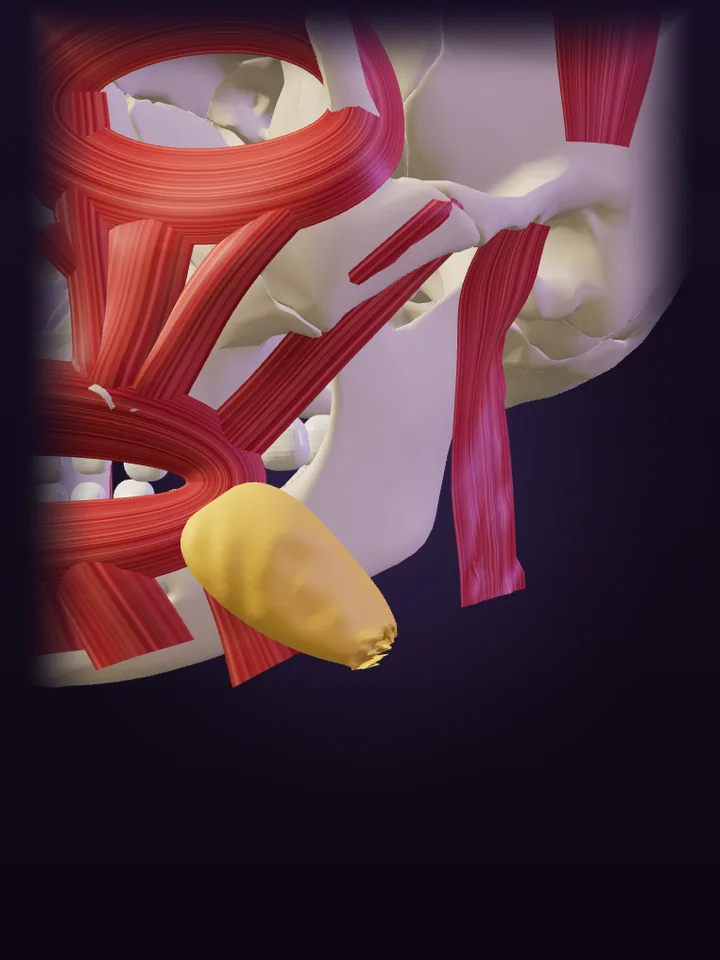 Ilustração 3D: Gordura de jowls