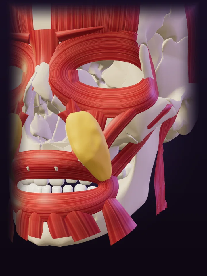 Ilustração 3D: Coxim nasolabial